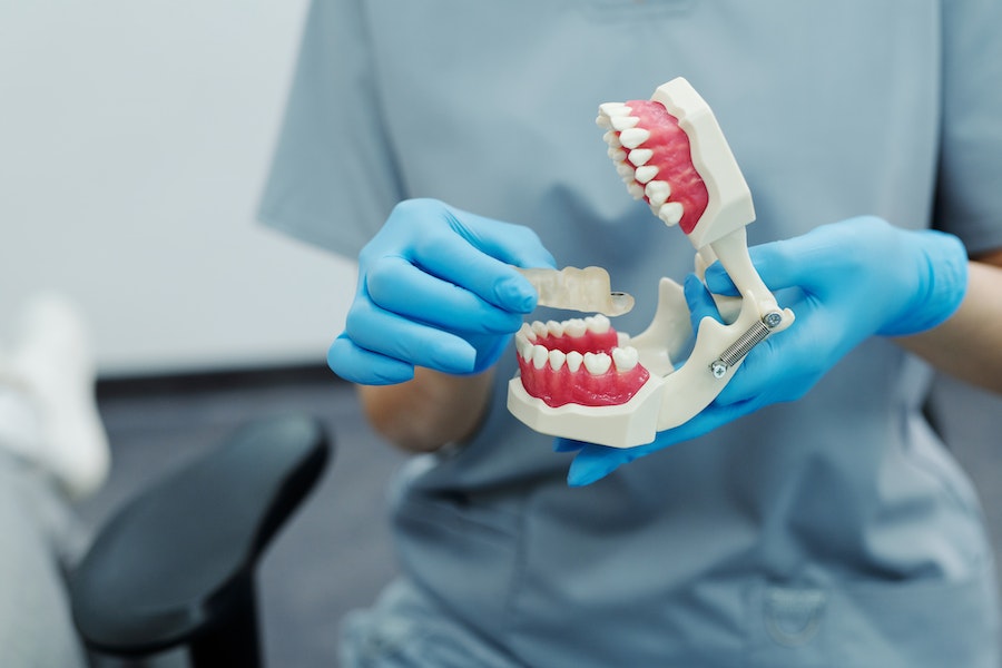 Da li su zubni implanti skupi?